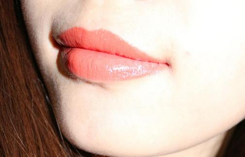 口角裂整形前的準(zhǔn)備與術(shù)后護(hù)理