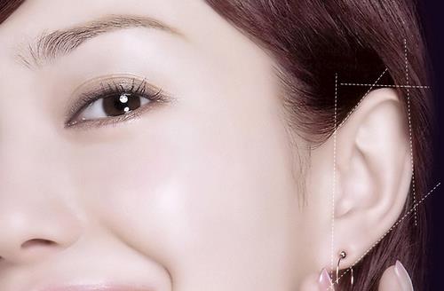 耳部整形手術(shù)注意事項