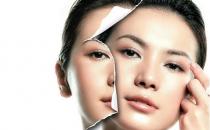 注射美白針美白有哪些誤區