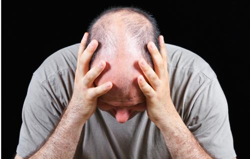 脫發(fā)男必看！防脫只需五招