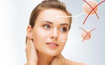 你在等痘痘熟透嗎？手癢擠痘誤大事