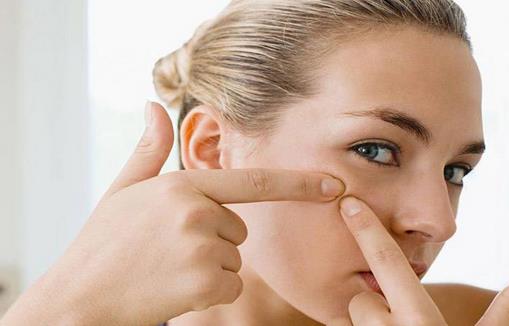 痘痘愈后不能放松 痘疤是最大敵人