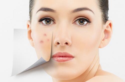 最有效的去痘食物療法