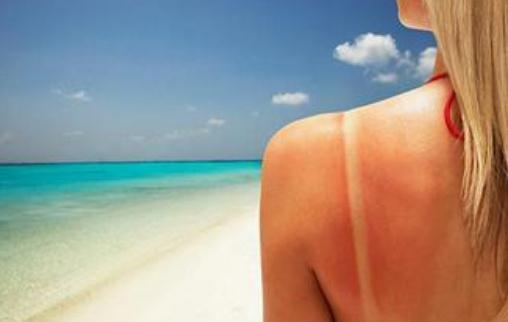 皮膚曬傷后應(yīng)該如何急救?