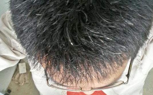 男人補腎護發如何飲食最正常