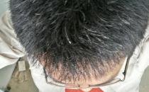 男人補腎護發如何飲食最正常