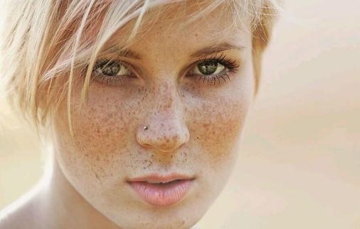 雀斑和吃鹽有關系?雀斑會遺傳嗎?
