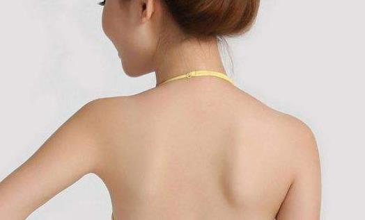 如何檢查是否患有宮頸息肉?