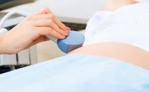 月經不調要做哪些檢查 四大檢查項目需牢記