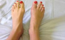 早上起來腳心疼怎么辦？