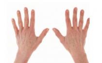 過敏性皮炎濕疹該怎么辦