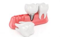 牙齒過早脫落當心是牙周炎！