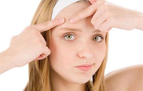 長痘痘的原因都有哪些