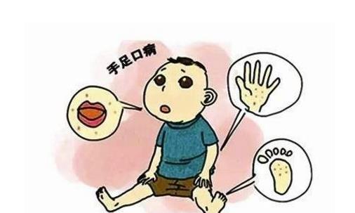什么是手足口??？手足口病怎么治療