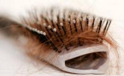 引起脫發的原因 學會這些方法遠離掉頭發