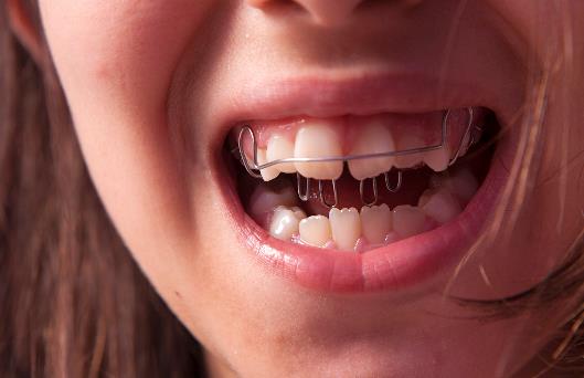 不同體質(zhì)對(duì)癥食療治磨牙