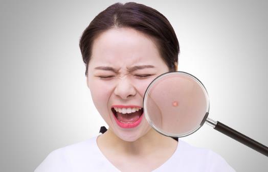 痘痘怎么消除,及時護理是必要的,如果臉上出現痘痘不要