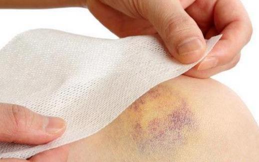 腿上莫名有淤青真是被鬼掐的嗎