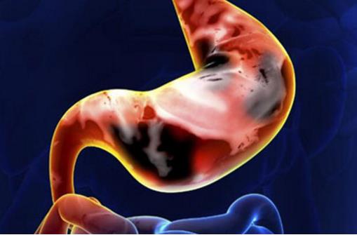 胃癌活動(dòng)期的飲食禁忌 晚期胃癌患者的護(hù)理大全