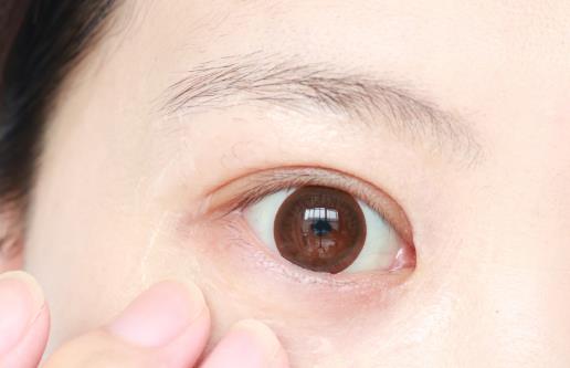 10個妙招去黑眼圈見效快