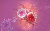 癌癥來臨之前身體發(fā)出的求救信號(hào) 預(yù)防癌癥刻不容緩