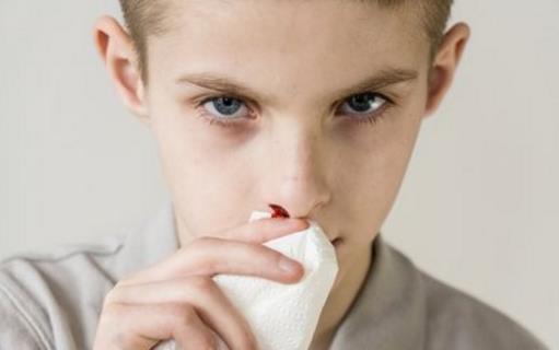 流鼻血和癌癥是否有關系 勿忽視身體發出的求救信號