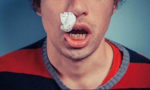 流鼻血和癌癥是否有關系 勿忽視身體發出的求救信號