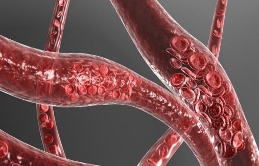 人到40歲血管易堵 吃什么可以清血管