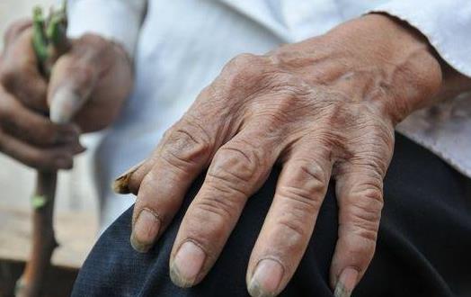 膽固醇高影響老年人健康 降膽固醇食物推薦