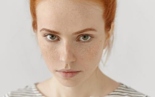 祛斑是美麗的天敵,如何去除祛斑