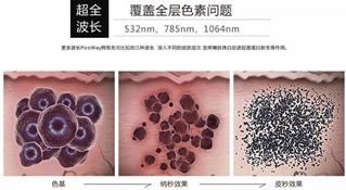 寧波薇琳整形醫(yī)院祛斑怎么樣?還您一張漂亮的容顏