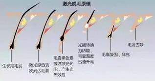 寧波薇琳整形醫(yī)院祛斑怎么樣?還您一張漂亮的容顏