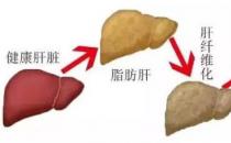 貴州治丙肝醫(yī)院靠不靠譜 貴州中醫(yī)肝病醫(yī)院質(zhì)量醫(yī)療的踐行者