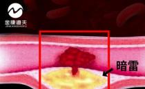 金康道夫水蛭素 輕松搞定血管堵塞 譽為“血管清道夫”