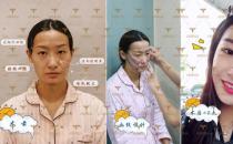 自體多肽脂肪實現新突破，塑造無法復制的自然美