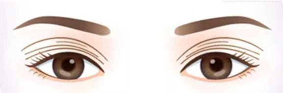 八大處整形趙延勇眼修復怎么樣 用實力鑄就業內口碑