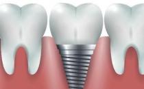 武漢德韓口腔：如何選擇好的種植牙機構呢？