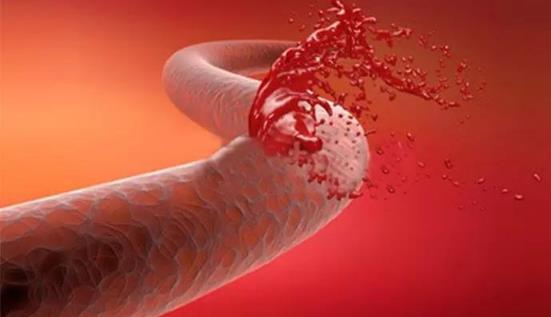 北京彤美整形醫(yī)院桂行軍科普:鼻整形術后飲食需要注意什么