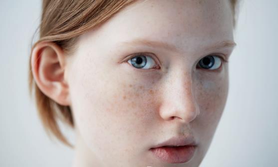 經(jīng)常化妝 臉上長斑怎么辦?