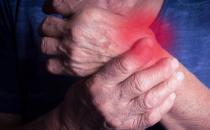 類風濕關節炎日常護理法 鍛煉常做關節拉伸運動