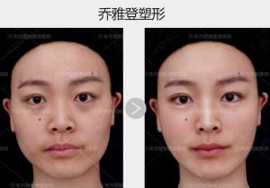 鄭州東方整形醫院喬妹VIP私享會圓滿成功