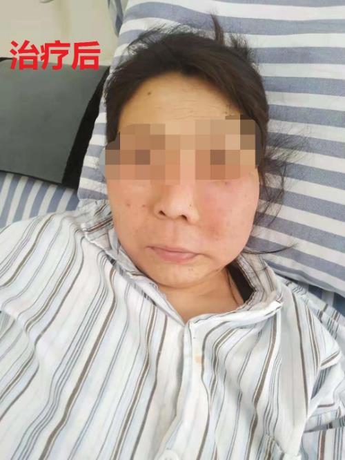 鄭州京美醫院腫瘤科好嗎?中醫專家 微創聯合治療