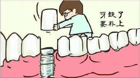 武漢德韓口腔揭秘！缺牙后什么時(shí)間去就診最好？