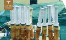 北京潤美玉之光張紅芳丨自體脂肪精度填充，在細節(jié)上提升效果