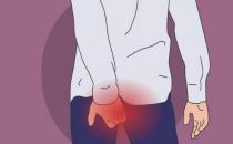 南充市東大肛腸醫院技術好嗎 告訴你痔瘡如何防治