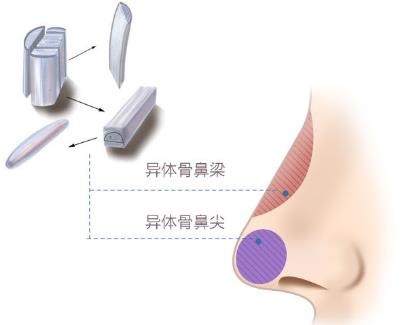 北京圣慈整形醫(yī)院鼻子王王軍怎么樣?專業(yè)實力 讓你放心美