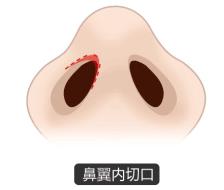 北京圣慈整形醫(yī)院鼻子王王軍怎么樣?專業(yè)實力 讓你放心美