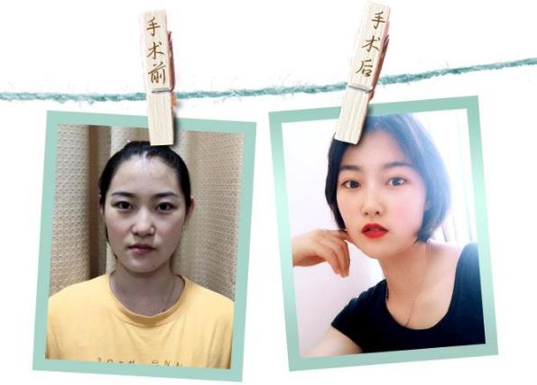 深圳恒妍整形技術如何 幫助廣大女性解決多重肌膚問題