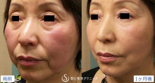 圣心醫療美容鐮倉達郎總院長，帶你探索年輕的秘密