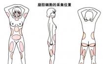 韋元強(qiáng)：產(chǎn)后能做自體脂肪豐胸嗎？